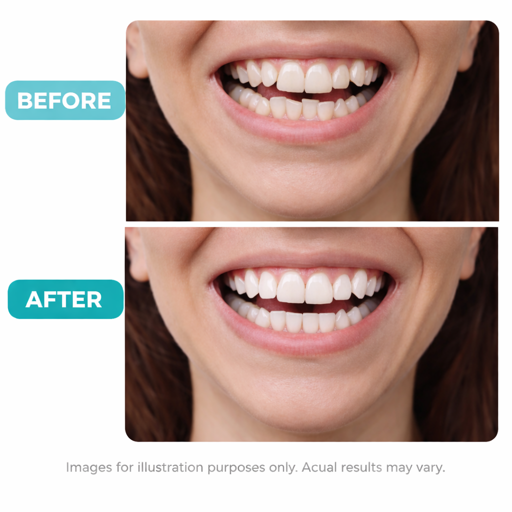 Teeth Alignment Services